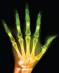 压力的手指关节？这是在医学诊断中使用X射线的另一个Exmaple。